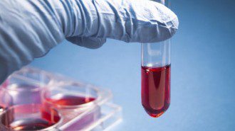 Кръвен тест показва колко ефирасно ще е лечението с антибиотици