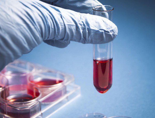 Кръвен тест показва колко ефирасно ще е лечението с антибиотици