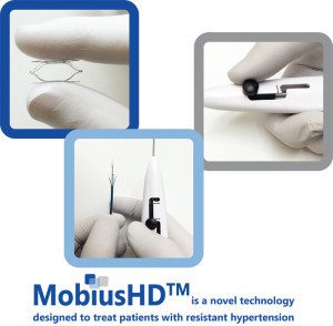 Устройството MobiusHD за лечение на резистентна хипертония получи одобрение от ЕС