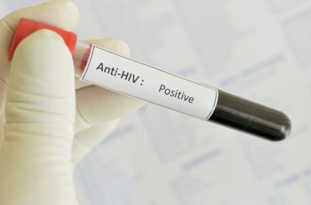 Мобилна лаборатория за безплатно изследване за ХИВ/СПИН ще работи днес в Горна Оряховица