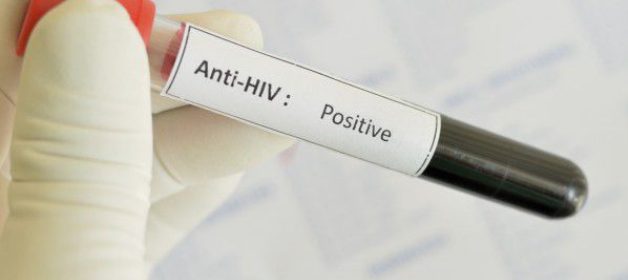Мобилна лаборатория за безплатно изследване за ХИВ/СПИН ще работи днес в Горна Оряховица