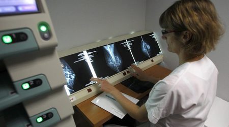 Особеност при една от 10 жени с рак на гърдата може да се окаже ключ към лечението й