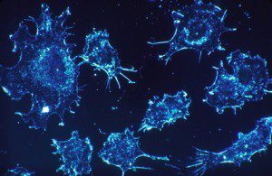 Откриха как гените на туморите помагат за лечението на рака