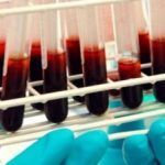 Шофьори вместо медици проверяват кръвните изследвания на пациенти