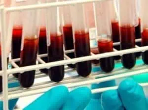 Шофьори вместо медици проверяват кръвните изследвания на пациенти