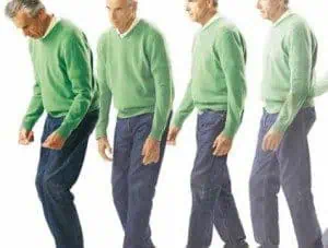 Безплатни прегледи за пациенти с Паркинсонова болест