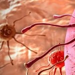 Ето ги признаците, че в тялото се развират ракови клетки