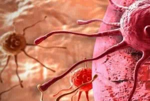 Ето ги признаците, че в тялото се развират ракови клетки