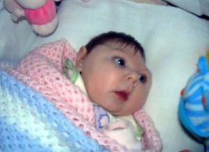 Великобритания в паника от Зика, в Испания - първо бебе с микроцефалия