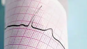 Българинът мре от сърце, стомах и дробове