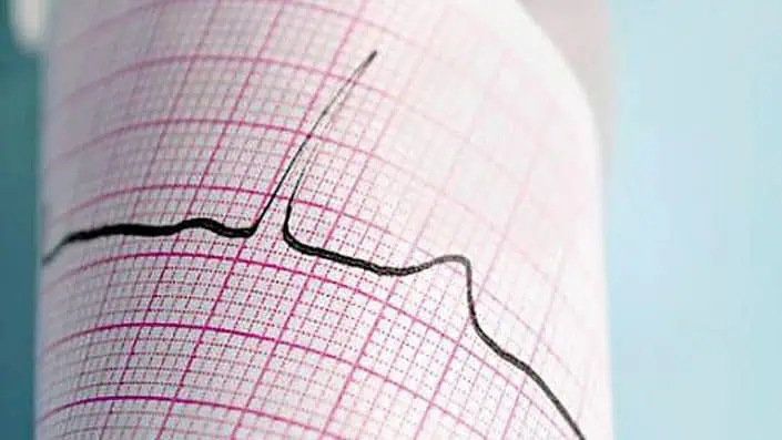 Българинът мре от сърце, стомах и дробове Българинът мре от сърце, стомах и дробове