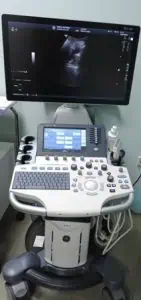 "Софиямед" модерна ехографска система за изследване на черния дроб