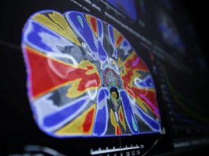 Община Бургас купува скенер за радиохирургия