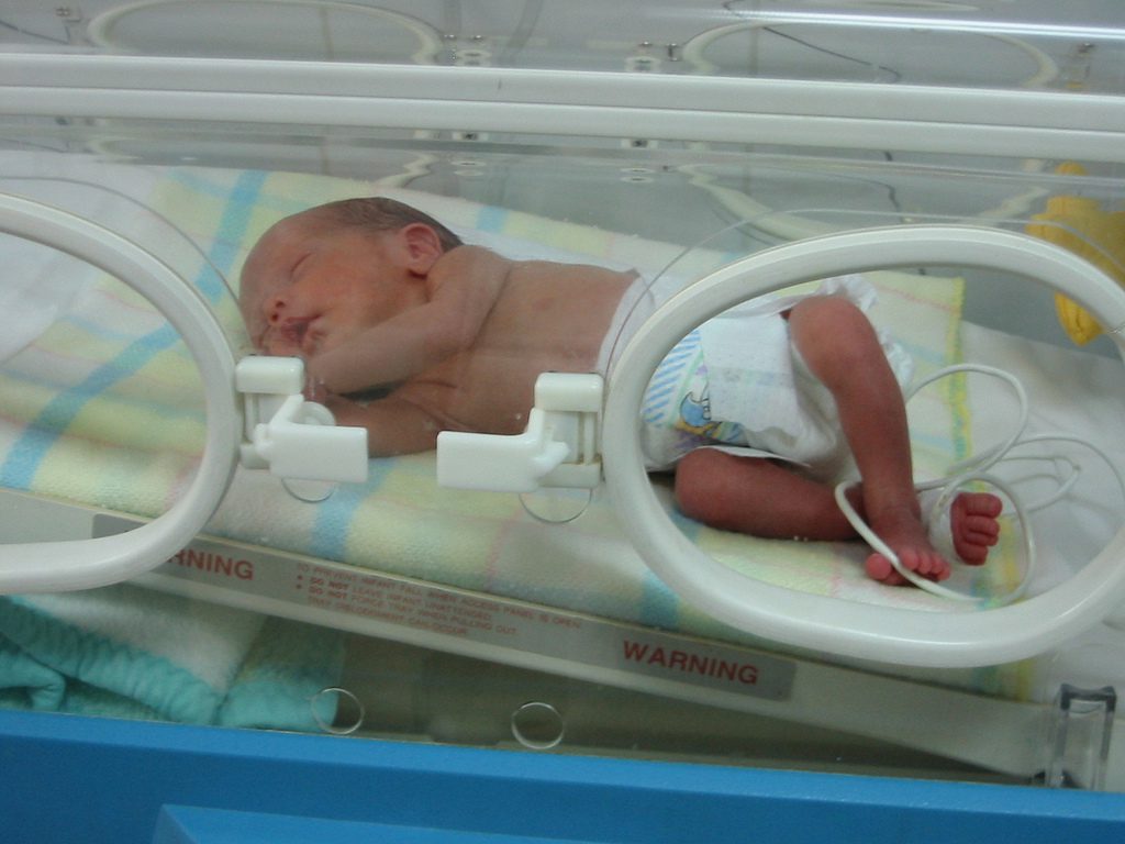 Стая за родилки и техните недоносени бебета се изгражда в МОБАЛ-Велико Търново
