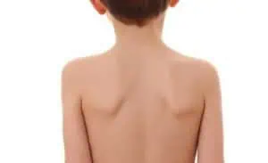 Започва кампания срещу гръбначните изкривявания при децата