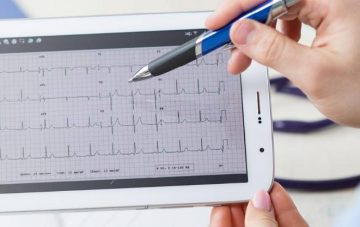 Отвъд възможностите на технологиите: Софтуер открива навреме сърдечните болести