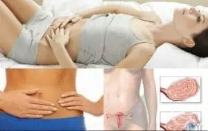 7 признака за рак на яйчниците
