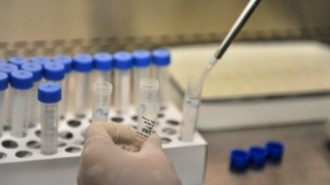 Тествали успешно лекарство срещу СПИН, измислено от българин