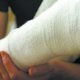 Жена изгуби дясната си ръка заради лекарски пропуск