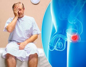 Ракът на простата поразява и без симптоми 