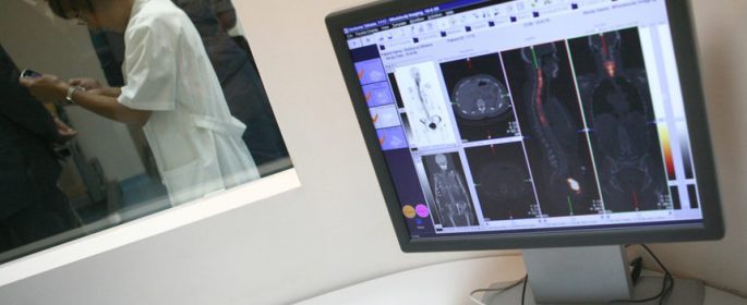 Онкологичните болници да се снабдят с нова специализирана апаратура, разпореди здравната каса