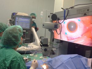 Операции с 3D очила в три очни болници