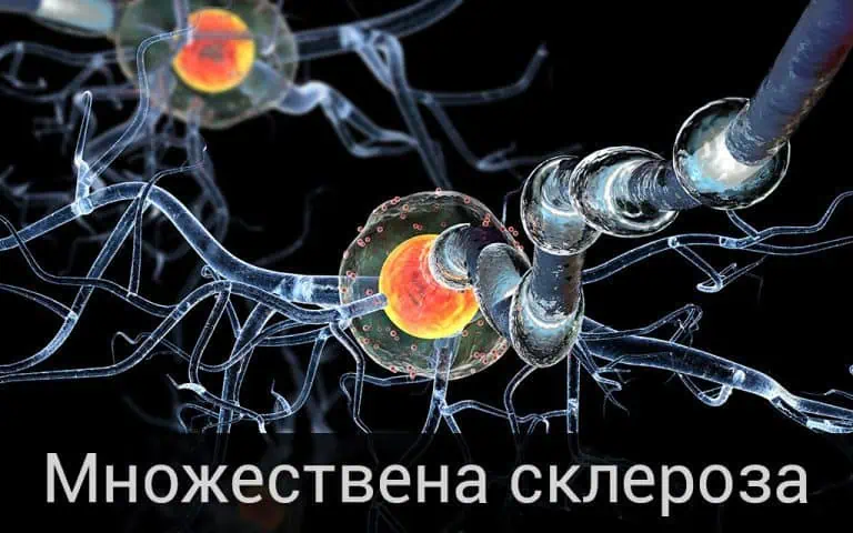 Стресът води до множествена склероза