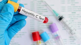 Безплатни тестове за хепатит В и С