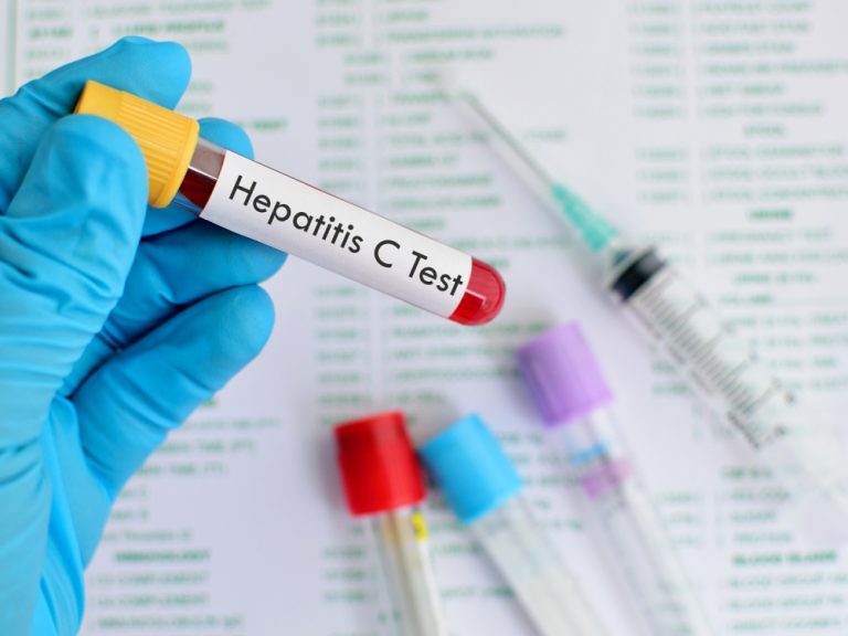 Безплатни тестове за хепатит В и С
