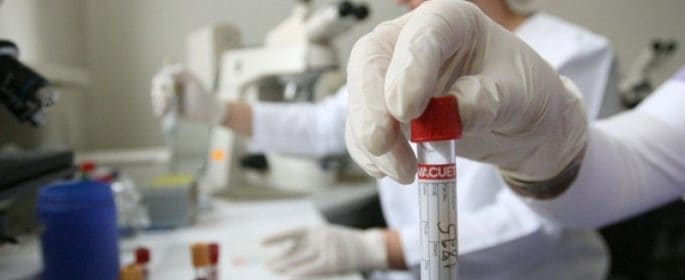 КЗК проверява Националния рамков договор