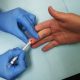 4 случая на заразени с Хепатит А в Луковит и Ловеч