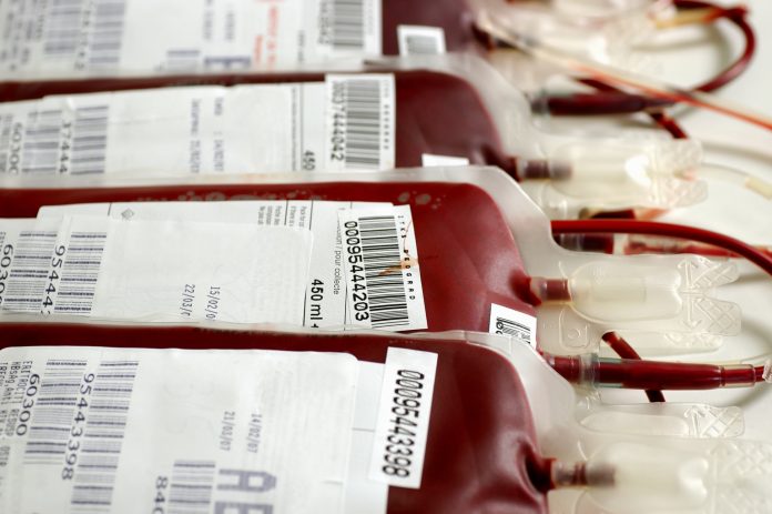 Националният център по кръводаряване не работи през почивните дни поради недостиг на лекари