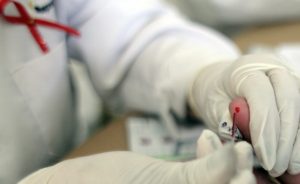 Нов случай на заразен с ХИВ в Кюстендилско