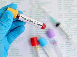 Хепатит С – болестта, която медицината победи