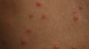 Коктейл от шарки в забавачките