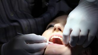 Проблемите със зъбите показват и риск от сърдечносъдови болести