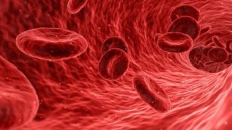 1500 сe разболяват на година от злокачествени заболявания на кръвта в България