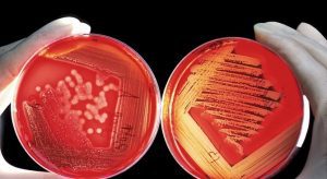 Учени предупреждават за епидемия, за която няма да има лекарства