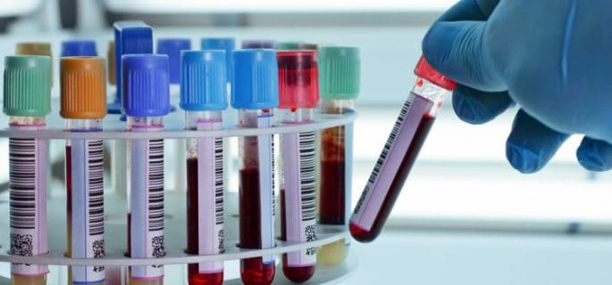 Изследванията преди операция включени ли са в клиничната пътека?