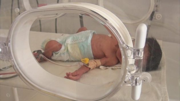 Холандски учени работят над „изкуствена утроба“ за недоносени бебета