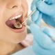 В кои случаи се дължи доплащане за стоматологични услуги?