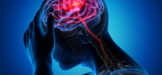 Мозъчният инсулт се случва при пристъп на мигрена