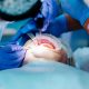 Оперативното отстраняване на зъби поема ли се от НЗОК?