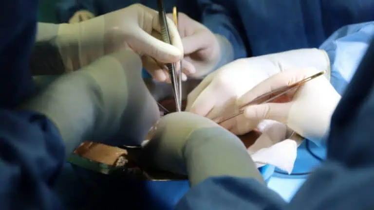 Пробойни в трансплантациите