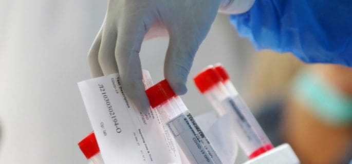 изследване на клетъчен имунитет