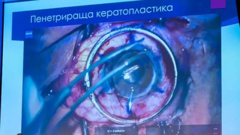 лечение на очните болести