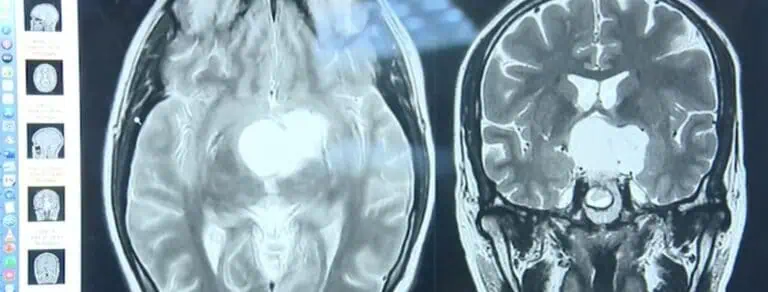 Проф. Минкин