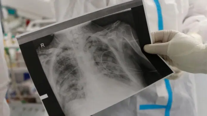 Да дишаш е привилегия Да дишаш е привилегия