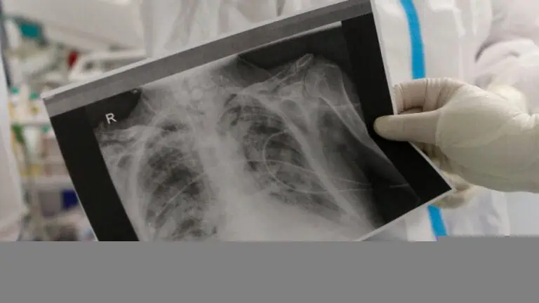 Да дишаш е привилегия