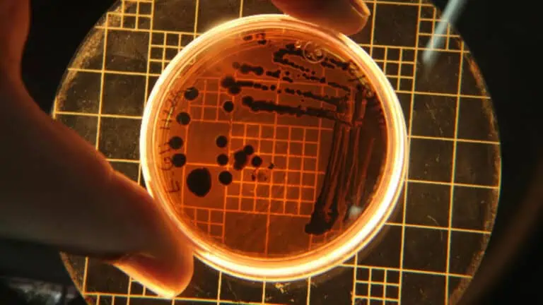 СЗО: Антимикробната резистентност продължава да нараства и заплашва устоите на медицината